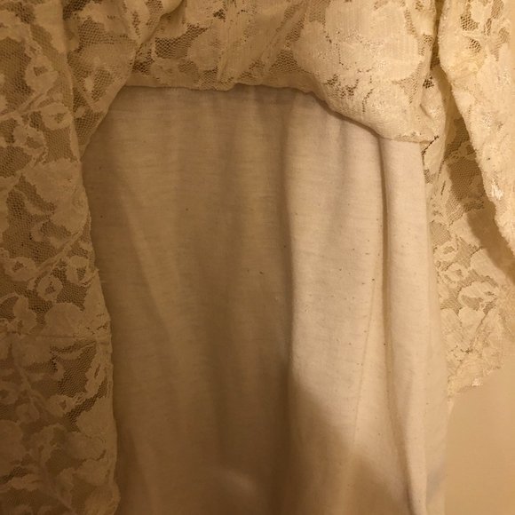 Aritzia Dillema Lace Skater Dress - Picture 11 of 16